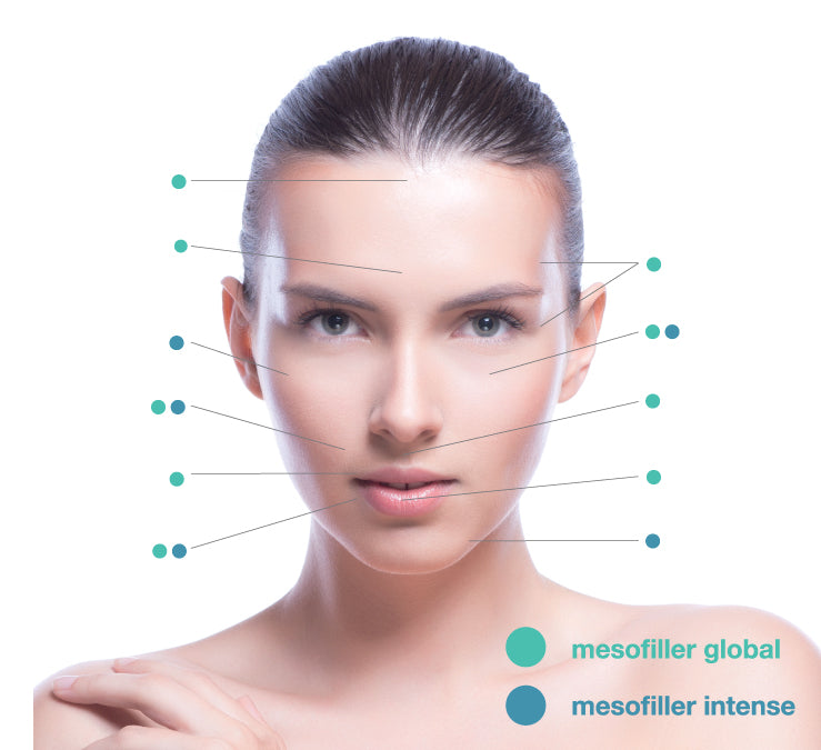mesofiller intense dermālā pildviela/ filleris - dynasty.lv