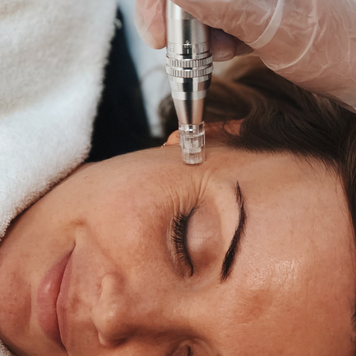 m.pen microneedling device