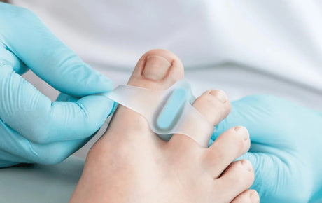 Podoloģe uzliek silikona pirkstu izpletēju hallux valgus korekcijai