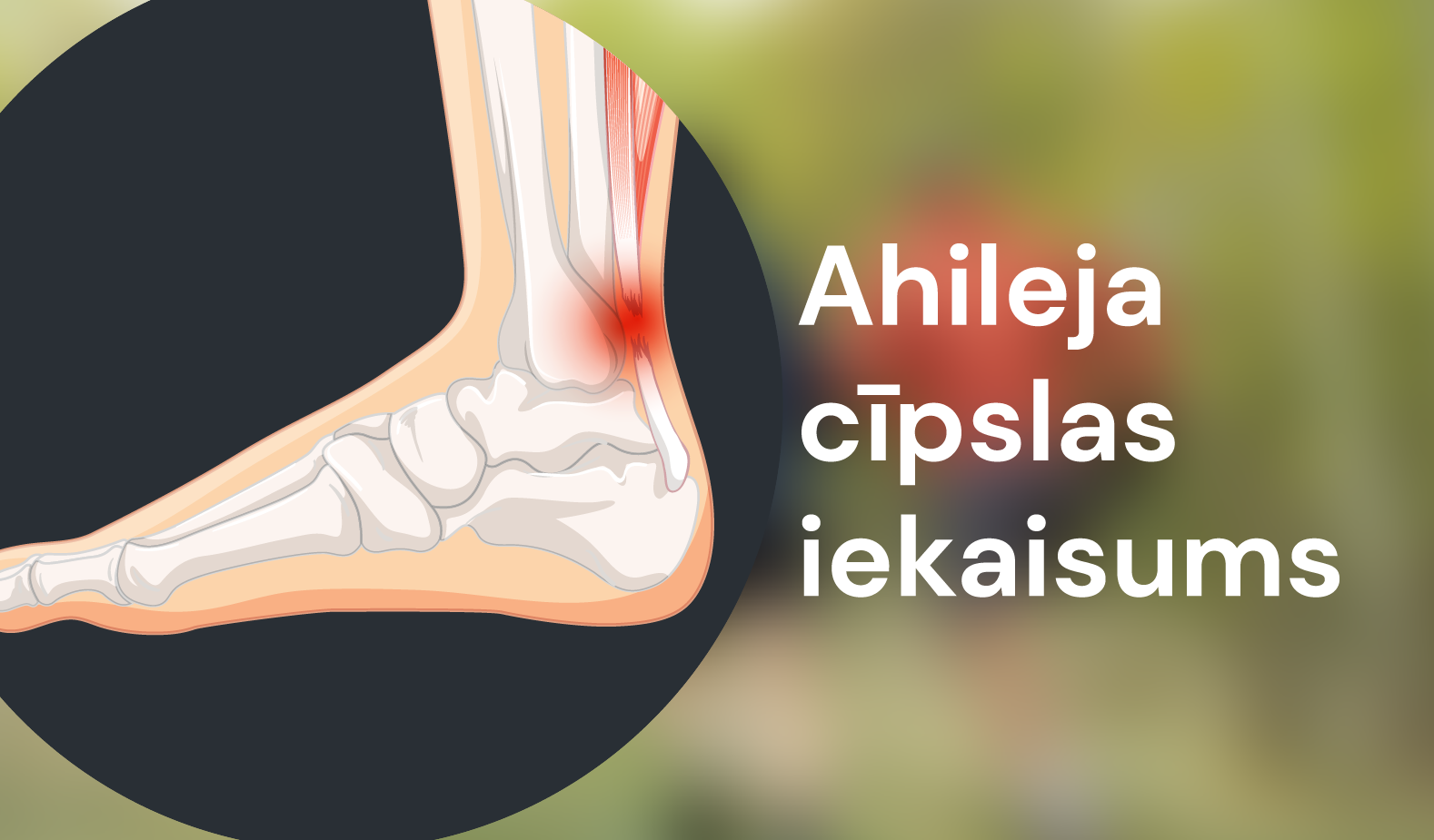 Ahileja cīpslas iekaisums: cēloņi un risinājumi